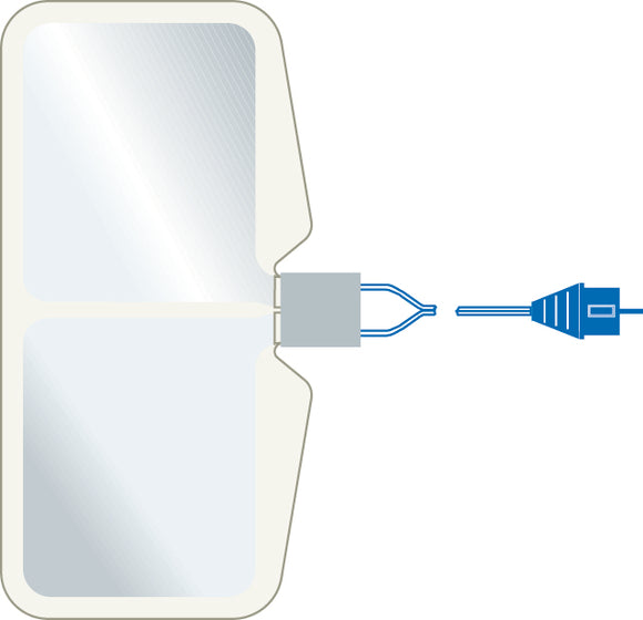 ERBE NESSYPlate 170, split, conductive area = 168 cm², with 3 m cable, Box of 50